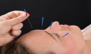 针灸培训哪家好 针灸培训哪家好